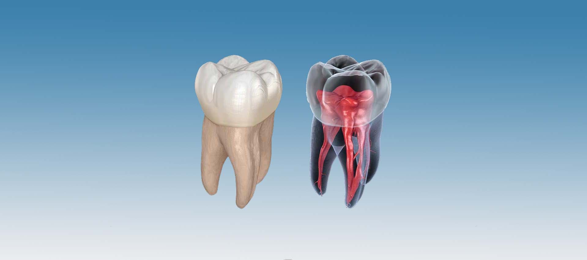 Smile transformation